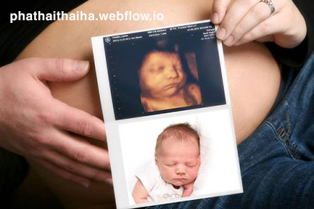 Thai nhi 32 tuần nặng bao nhiêu?